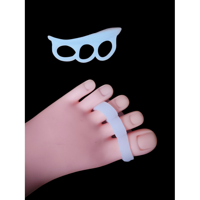 İleri derecede çekiç parmak yastığı